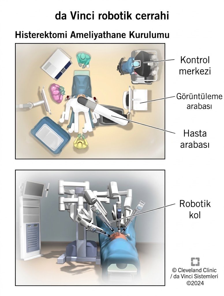 tÜrk 1
