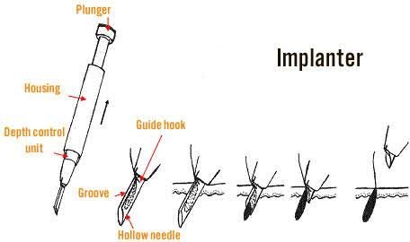 images