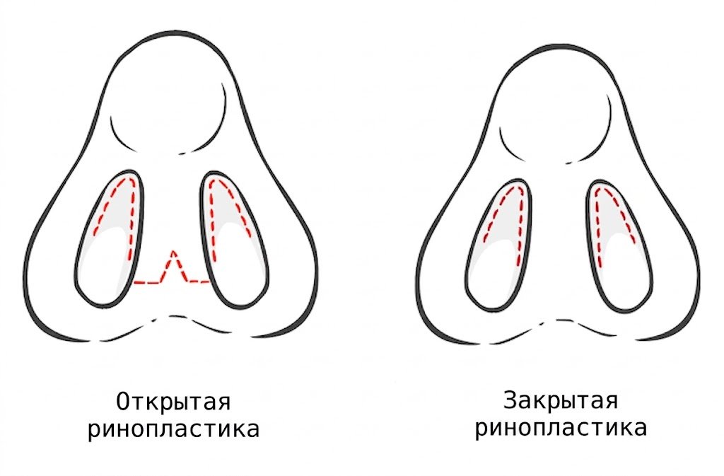 rus 1