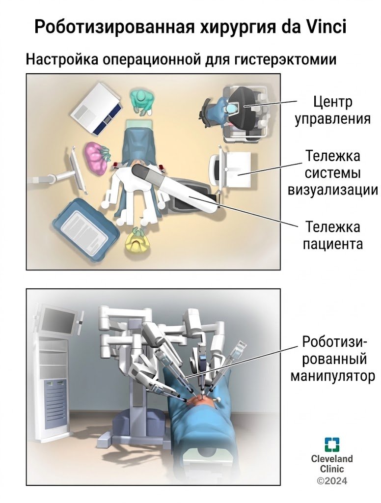 rus 1