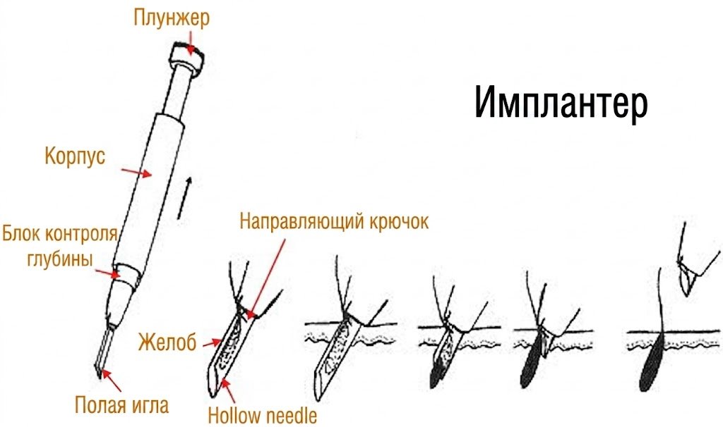 rus 2