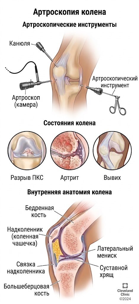 rus 2